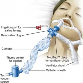 Close Suction Tube System